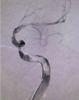 COHEN-Procedure2__0000_image-4