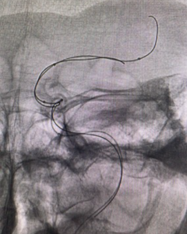 COHEN-Procedure2__0003_image-1