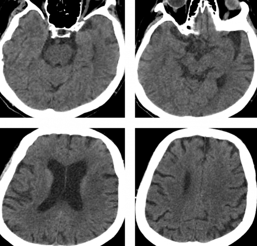 Pre-Op imaging