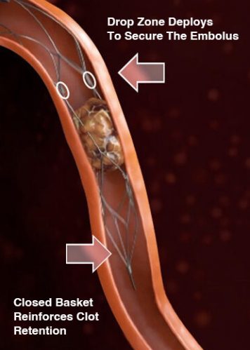 pvasc_diagram_images_v3Extract pvasc_diagram_images_v3Extract